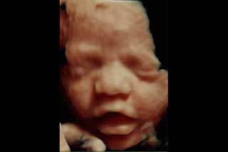 Ecografía 3d Manizales Pereira